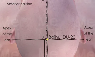 Baihui DU-20 location