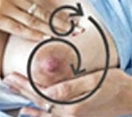 Breast massage against clogged milk ducts step 2 bis