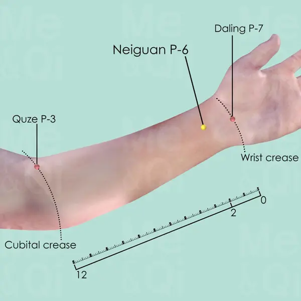 Neiguan PC-6 location